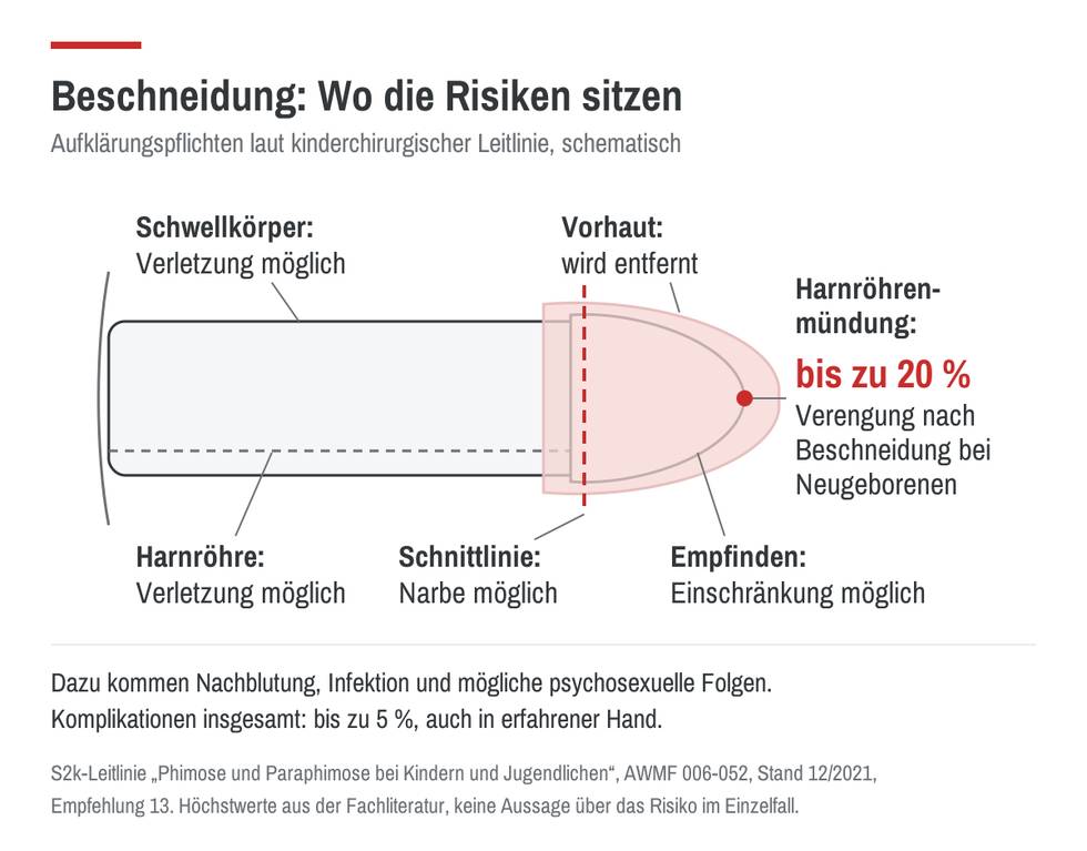 beschneidung-risiken-schema.png