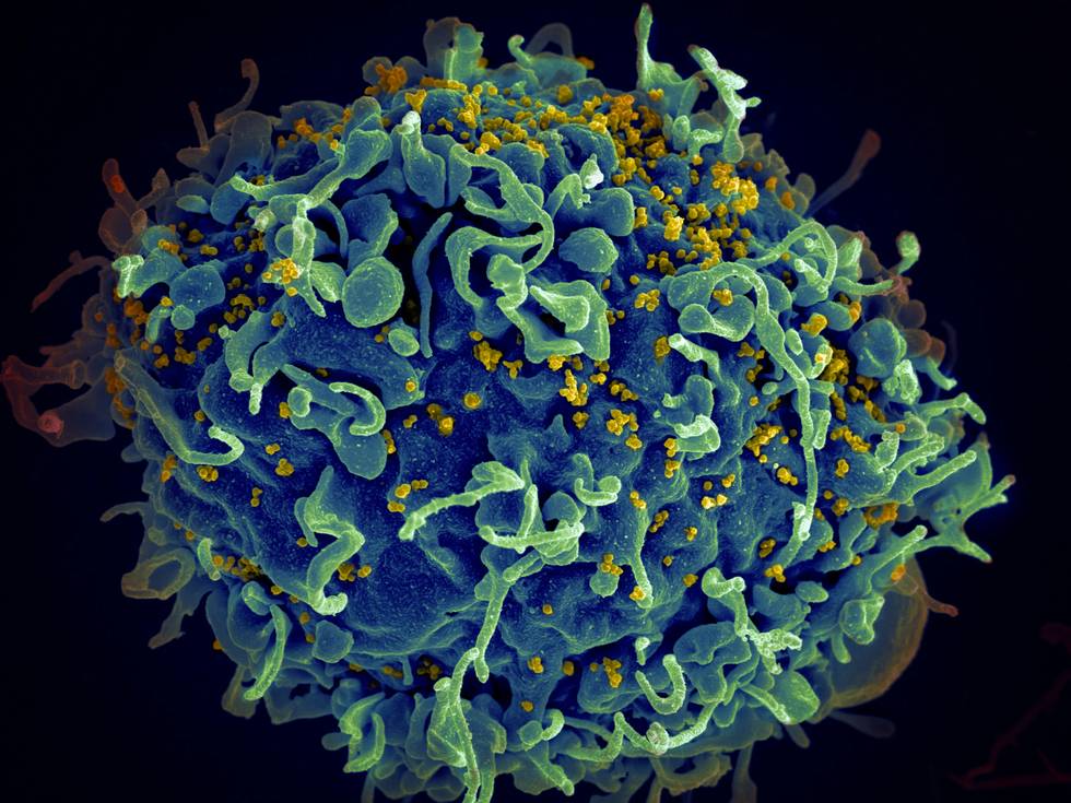 HIV-Virus
